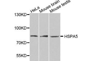 Western blot analysis of extracts of various cell lines, using HSPA5 antibody. (GRP78 Antikörper  (AA 550-650))