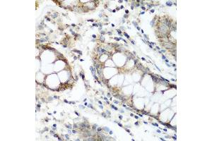 Immunohistochemistry of paraffin-embedded human colon using N antibody (ABIN6133455, ABIN6144330, ABIN6144331 and ABIN6223249) at dilution of 1:200 (40x lens). (NAT15 Antikörper  (AA 1-242))