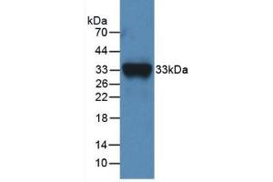 Detection of Recombinant F11, Mouse using Polyclonal Antibody to Coagulation Factor XI (F11) (Factor XI Antikörper  (AA 157-389))