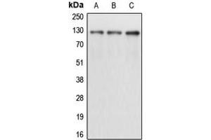 Western blot analysis of CD167a expression in A431 (A), K562 (B), T47D (C) whole cell lysates. (DDR1 Antikörper  (Center))