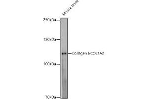 Western blot analysis of extracts of Mouse bone, using Collagen I/COL1 antibody (1059) at 1:1000 dilution. (COL1A2 Antikörper)