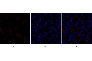 Immunofluorescence analysis of mouse kidney tissue.