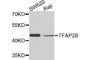 Western blot analysis of extracts of SW620 and Raji cells, using TFAP2B antibody. (TFAP2B Antikörper)