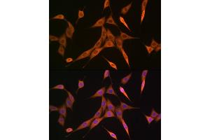 Immunofluorescence analysis of NIH-3T3 cells using RHOA/RHOB/RHOC Rabbit mAb (ABIN1678636, ABIN3019244, ABIN3019245 and ABIN7101735) at dilution of 1:100 (40x lens). (RhoA,B,C Antikörper)