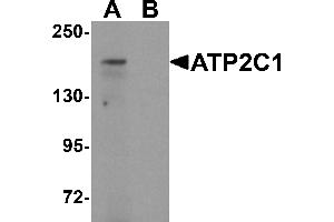 Western blot analysis of ATP2C1 in mouse brain tissue lysate with ATP2C1 antibody at 1 µg/mL in (A) the absence and (B) the presence of blocking peptide. (ATP2C1 Antikörper  (C-Term))