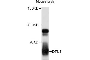 Western blot analysis of extracts of mouse brain, using DTNB antibody (ABIN6294202) at 1:3000 dilution. (Dystrobrevin beta Antikörper)