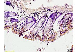Formalin-fixed and paraffin embedded mouse intestine labeled with Anti-EGFRvIII Polyclonal Antibody, unconjugated  (ABIN742035) at 1: 200 followed by incubation with conjugated secondary antibody and DAB staining (EGFRviii Antikörper  (AA 1-50))