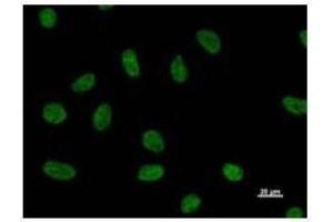 Immunostaining analysis in HeLa cells. (NUDT21 Antikörper)