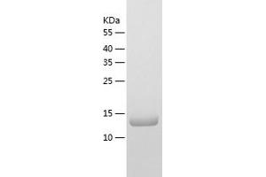 Western Blotting (WB) image for Kisspeptin (KISS1) (AA 20-138) protein (His tag) (ABIN7123693) (KISS1 Protein (AA 20-138) (His tag))