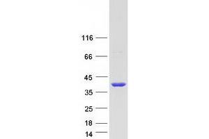 Western Blotting (WB) image for N-Ethylmaleimide Sensitive Fusion Protein Attachment Protein beta (NAPB) protein (Myc-DYKDDDDK Tag) (ABIN2732297)