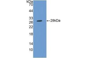 Western blot analysis of recombinant Human MMP14. (MMP14 Antikörper  (AA 112-321))