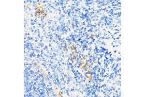Immunohistochemistry of paraffin-embedded mouse spleen using CAMP antibody (ABIN3022305, ABIN3022306, ABIN3022307, ABIN1512664 and ABIN6218724) at dilution of 1:200 (40x lens). (Cathelicidin Antikörper  (AA 31-170))