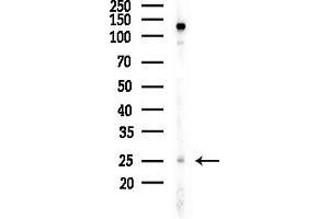 anti-Myogenic Factor 5 (MYF5) (N-Term) antibody
