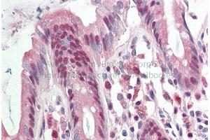 Rabbit Anti-RAD23B antibody Catalog Number: ARP56505 Formalin Fixed Paraffin Embedded Tissue: Human Adult Colon  Observed Staining: Cytoplasm in hepatocytes Primary Antibody Concentration: 1:600 Secondary Antibody: Donkey anti-Rabbit-Cy3 Secondary Antibody Concentration: 1:200 Magnification: 20X Exposure Time: 0. (RAD23B Antikörper  (Middle Region))