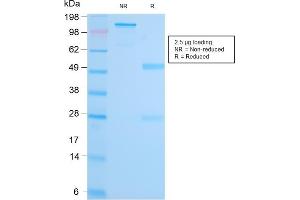 SDS-PAGE Analysis Purified MALT1 Recombinant Rabbit Monoclonal Antibody (MT1/3159R). (Rekombinanter MALT1 Antikörper  (AA 701-808))