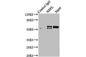 Immunoprecipitating NEFL in mouse brain tissue Lane 1: Rabbit control IgG instead of ABIN7161278 in mouse brain tissue. (NEFL Antikörper  (AA 128-271))