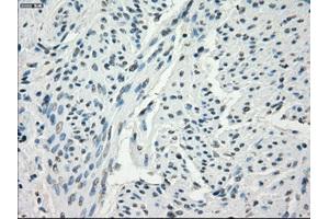 Immunohistochemical staining of paraffin-embedded endometrium tissue using anti-FCGR2A mouse monoclonal antibody. (FCGR2A Antikörper)
