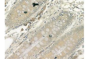 ABIN6261221 and ABIN6278110 at 1/100 staining human normal colon tissue by IHC-P. (DAP Kinase 1 Antikörper  (Internal Region))