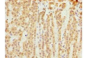Immunohistochemistry of paraffin-embedded human adrenal gland tissue using ABIN7159878 at dilution of 1:100 (SLC25A18 Antikörper  (AA 246-287))