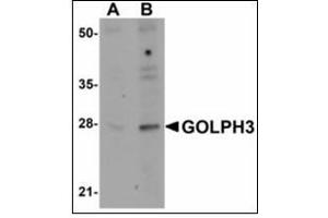 Western blot analysis of GOLPH3 in rat lung tissue lysate with GOLPH3 antibody at (A) 0.