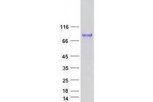 Validation with Western Blot (Uromodulin Protein (UMOD) (Transcript Variant 1) (Myc-DYKDDDDK Tag))