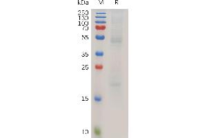 SDS-PAGE (SDS) image for Advanced Glycosylation End Product-Specific Receptor (AGER) (AA 27-340) protein (His tag) (ABIN7490915)