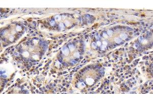 Detection of CD3e in Human Small intestine Tissue using Polyclonal Antibody to T-Cell Surface Glycoprotein CD3 Epsilon (CD3e) (CD3 epsilon Antikörper  (AA 28-185))