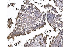 IHC analysis of FXR1 using anti-FXR1 antibody (ABIN7600093).