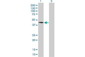 Western Blot analysis of DYX1C1 expression in transfected 293T cell line by DYX1C1 MaxPab polyclonal antibody. (DYX1C1 Antikörper  (AA 1-381))