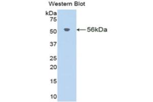 Western Blotting (WB) image for anti-Klotho beta (KLB) (AA 515-965) antibody (ABIN1859545) (Klotho beta Antikörper  (AA 515-965))