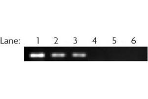 RbAp46/48 antibody (pAb) tested by ChIP ChIP performed on MCF7 cell chromatin (40 μg) using 39198. (RbAp46/48 Antikörper)