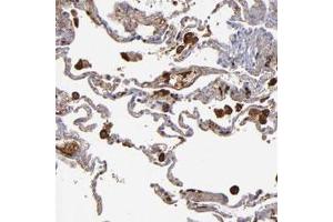 Immunohistochemical staining of human lung with C1QA polyclonal antibody  shows strong cytoplasmic positivity in macrophages. (C1QA Antikörper)