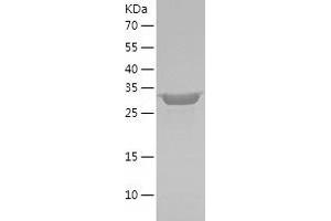 Western Blotting (WB) image for Sirtuin 5 (SIRT5) (AA 34-310) protein (His tag) (ABIN7289106) (SIRT5 Protein (AA 34-310) (His tag))