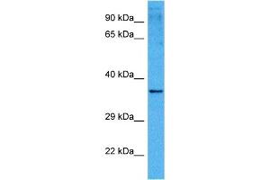 Host:  Mouse  Target Name:  PITX1  Sample Tissue:  Mouse Kidney  Antibody Dilution:  1ug/ml