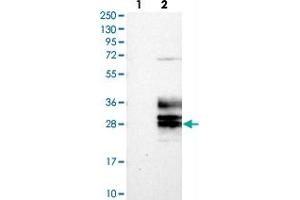Western blot analysis of Lane 1: Negative control (vector only transfected HEK293T lysate), Lane 2: Over-expression Lysate (Co-expressed with a C-terminal myc-DDK tag (~3. (Clarin 3 Antikörper)