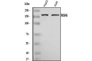 Western blot analysis of MSH6 using anti-MSH6 antibody (ABIN7601449).