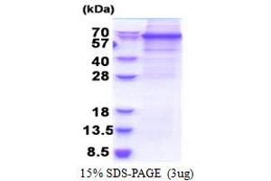 SDS-PAGE (SDS) image for DEAD (Asp-Glu-Ala-Asp) Box Polypeptide 56 (DDX56) (AA 1-547) protein (His tag) (ABIN5853279)