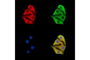 ABIN7095999 and ABIN7100061 staining Hela cells by IF/ICC. (SOSTDC1 Antikörper)