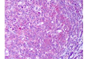Anti-IL-13 antibody IHC of human tonsil, germinal center. (IL-13 Antikörper)