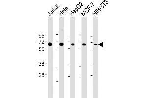 All lanes : Anti-PSMD3 Antibody (C-Term) at 1:2000 dilution Lane 1: Jurkat whole cell lysate Lane 2: Hela whole cell lysate Lane 3: HepG2 whole cell lysate Lane 4: MCF-7 whole cell lysate Lane 5: NIH/3T3 whole cell lysate Lysates/proteins at 20 μg per lane. (PSMD3 Antikörper  (AA 482-515))