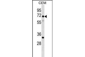 NPLOC4 Antibody (C-term) (ABIN1537359 and ABIN2848982) western blot analysis in CEM cell line lysates (35 μg/lane).