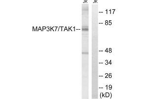 Western Blotting (WB) image for anti-Mitogen-Activated Protein Kinase Kinase Kinase 7 (MAP3K7) (Thr187) antibody (ABIN1848228) (MAP3K7 Antikörper  (Thr187))