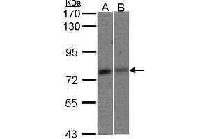 WB Image Sample(30 μg of whole cell lysate) A:293T B:A431, 7. (MTA2 Antikörper  (C-Term))