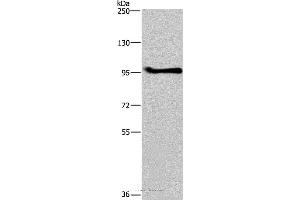 Western blot analysis of A549 cell, using LLGL1 Polyclonal Antibody at dilution of 1:350 (LLGL1 Antikörper)