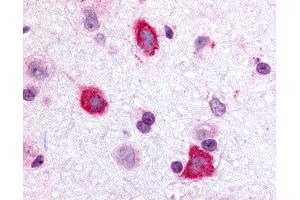 Anti-GALR3 antibody IHC of rat brain, hippocampus. (GALR3 Antikörper  (Cytoplasmic Domain))