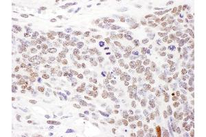 Immunohistochemistry (IHC) image for anti-Structural Maintenance of Chromosomes 1A (SMC1A) (pSer957) antibody (ABIN7453448)