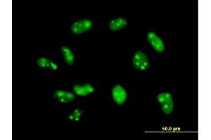 Immunofluorescence of purified MaxPab antibody to EXOSC7 on HeLa cell. (EXOSC7 Antikörper  (AA 1-291))