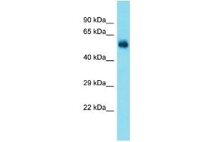 Host:  Rabbit  Target Name:  Taf1a  Sample Type:  Rat Brain lysates  Antibody Dilution:  1. (TAF1A Antikörper  (N-Term))