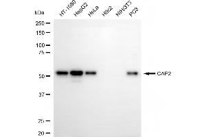 Western blotting analysis using CAP2 antibody (ABIN7797526). (Rekombinanter CAP2 Antikörper)