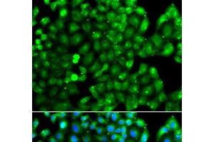 Immunofluorescence analysis of A549 cells using HLA-DRB1 Polyclonal Antibody (HLA-DRB1 Antikörper)